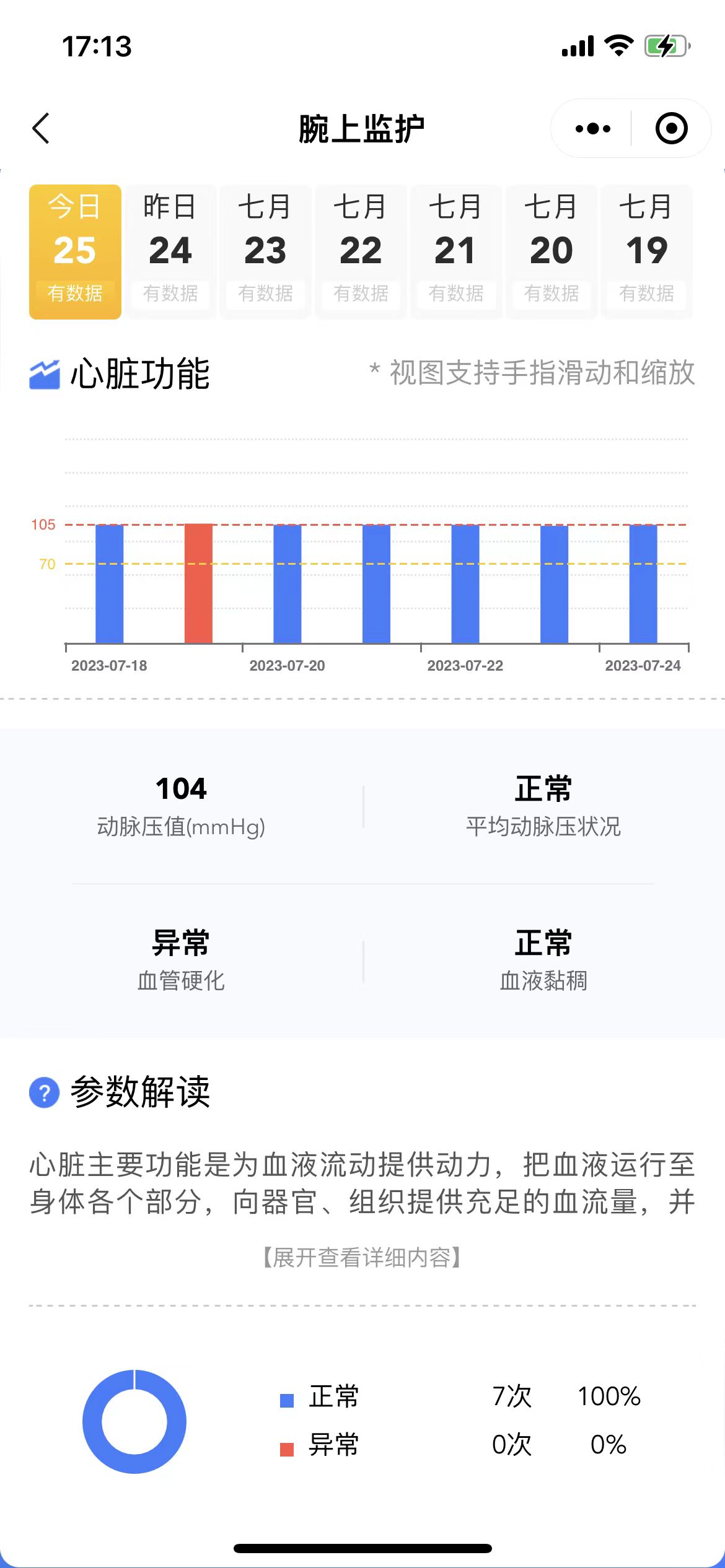 心脏监测