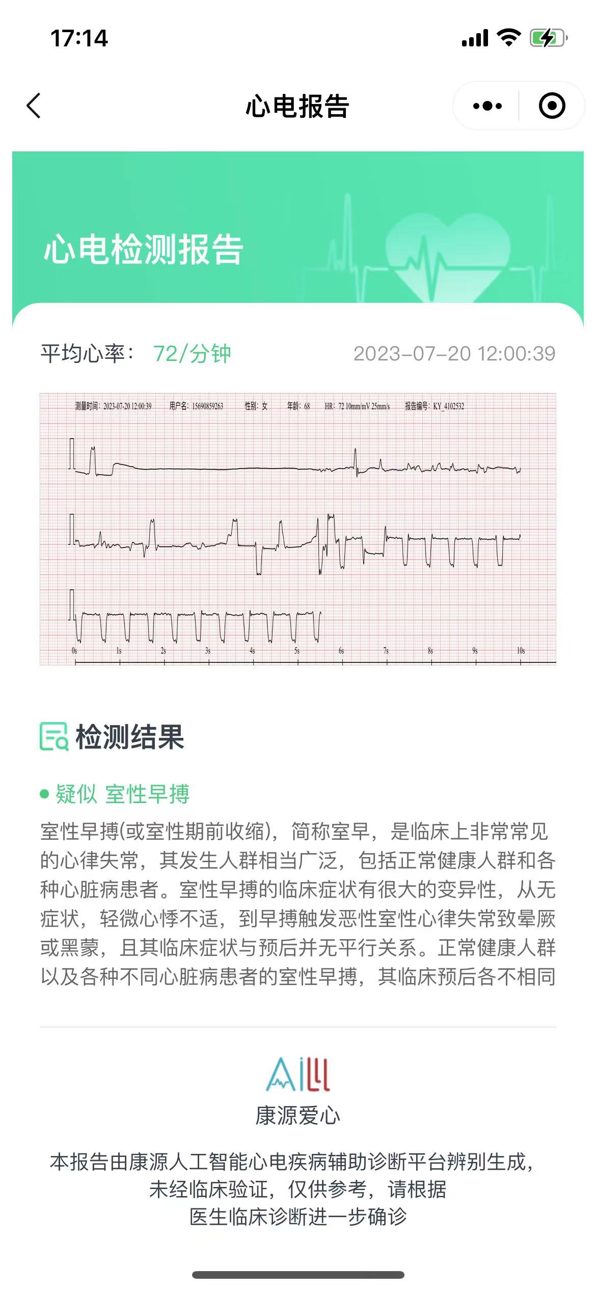 心电报告